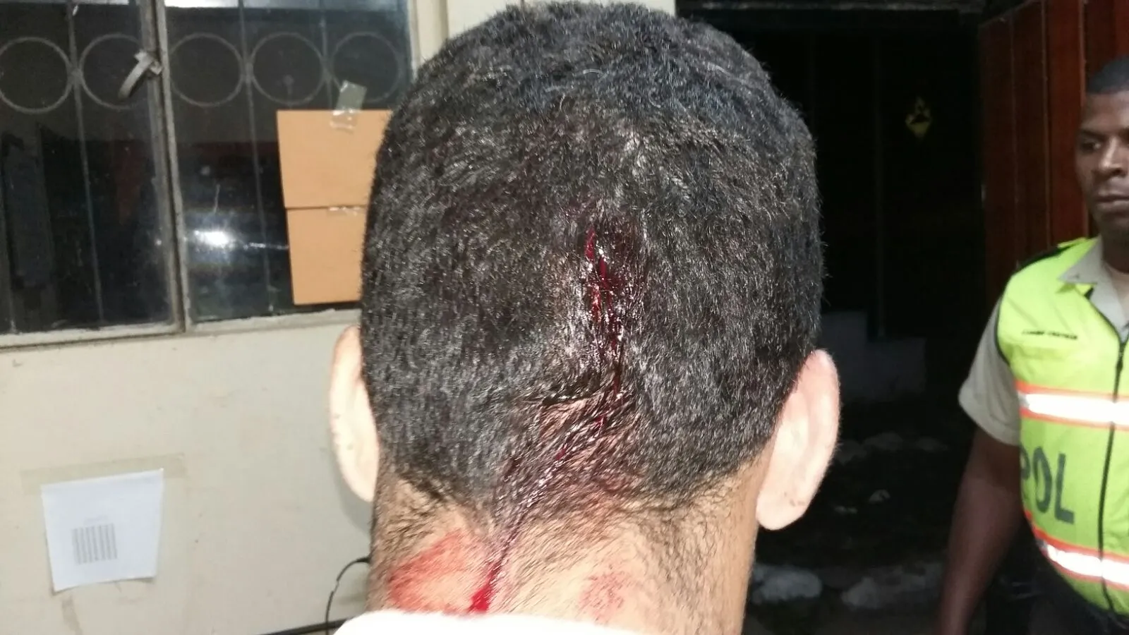 El policía que fue agredido en su cuero cabelludo